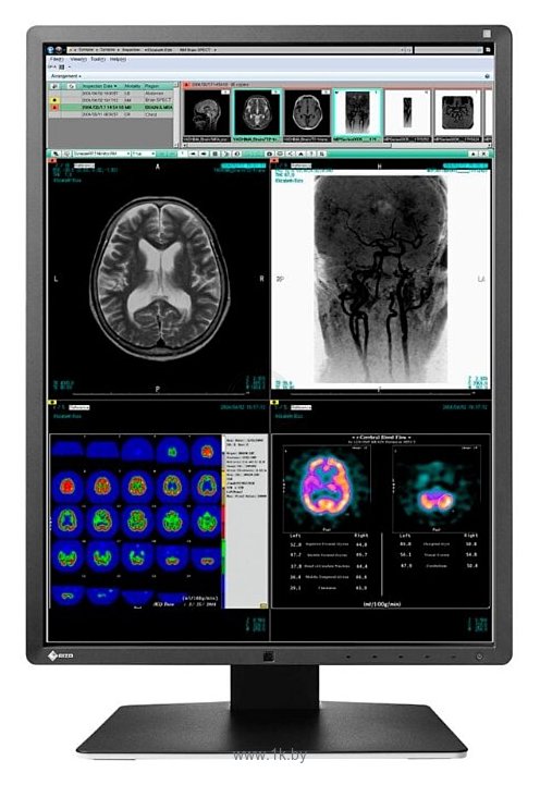 Фотографии Eizo RadiForce RX350