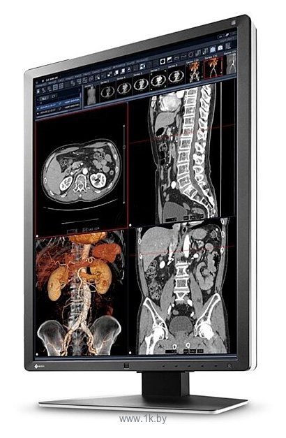 Фотографии Eizo RadiForce RX250