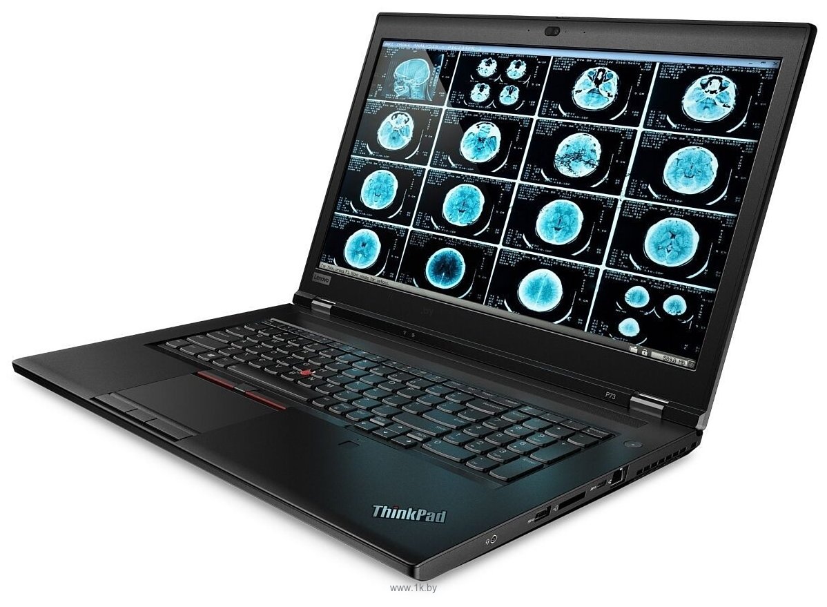 Фотографии Lenovo ThinkPad P73 (20QR002ART)